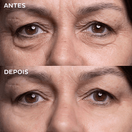 Resultado antes e depois Firmage - Caso 5